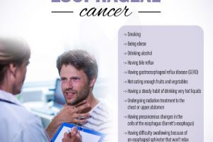 risk factors of esophageal cancer