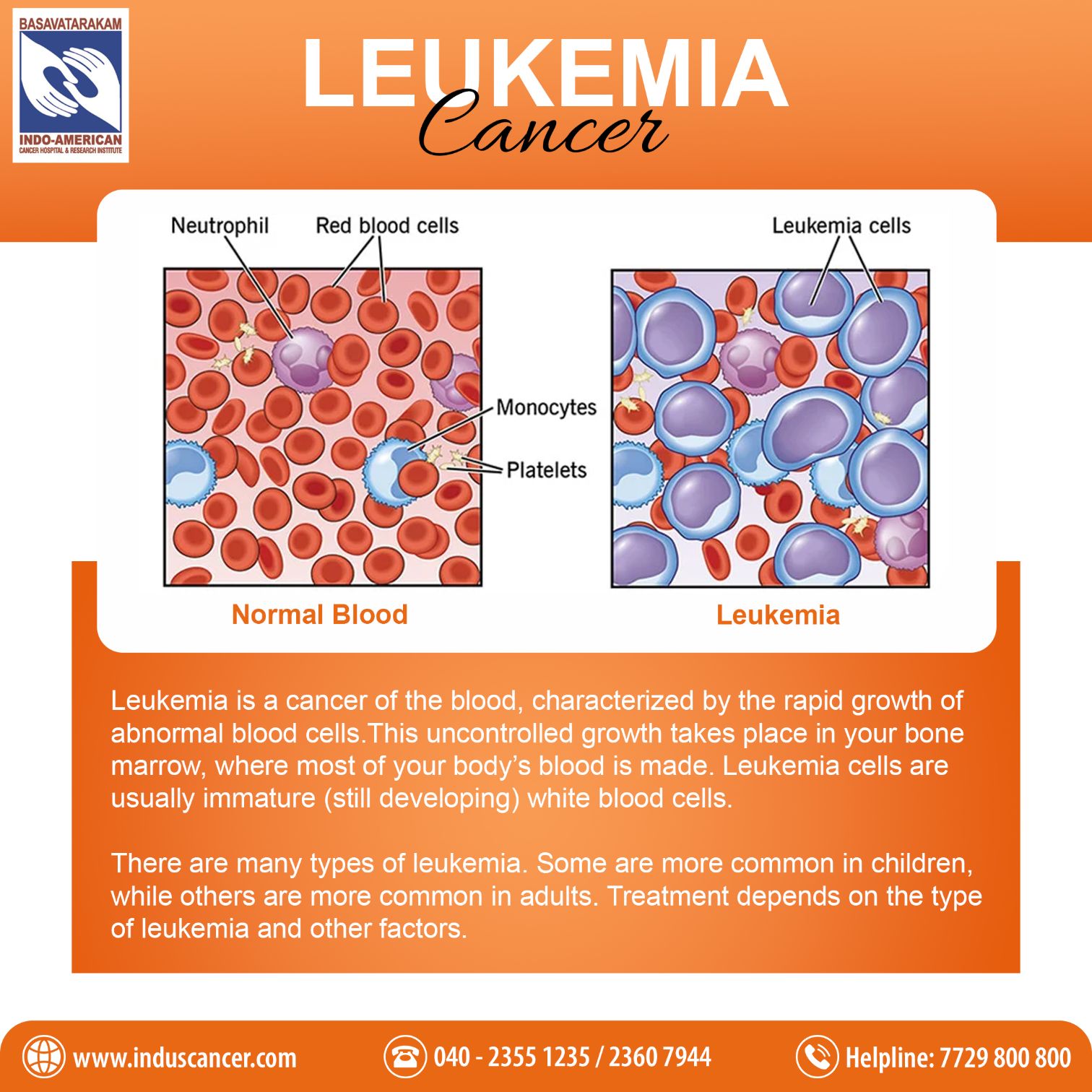 Comprehensive Guide to Leukemia: Symptoms, Causes, Treatment, Types ...