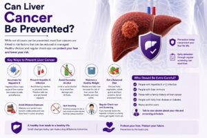 Liver Cancer