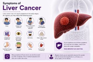 Liver Cancer