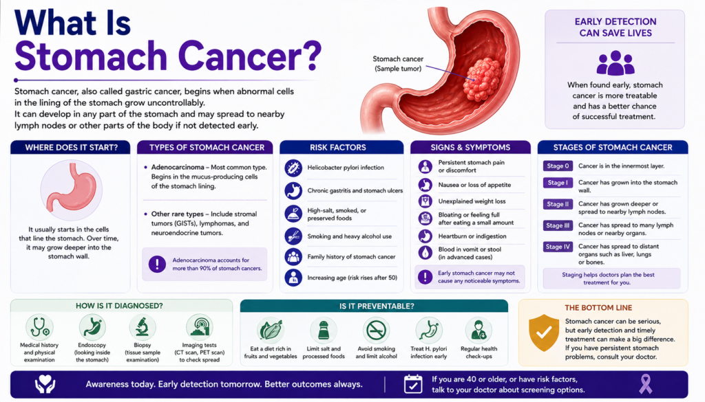 Stomach Cancer
