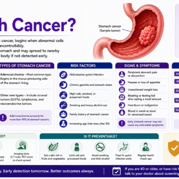 Stomach Cancer