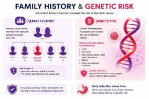 Stomach Cancer
