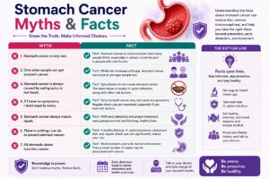 Stomach Cancer